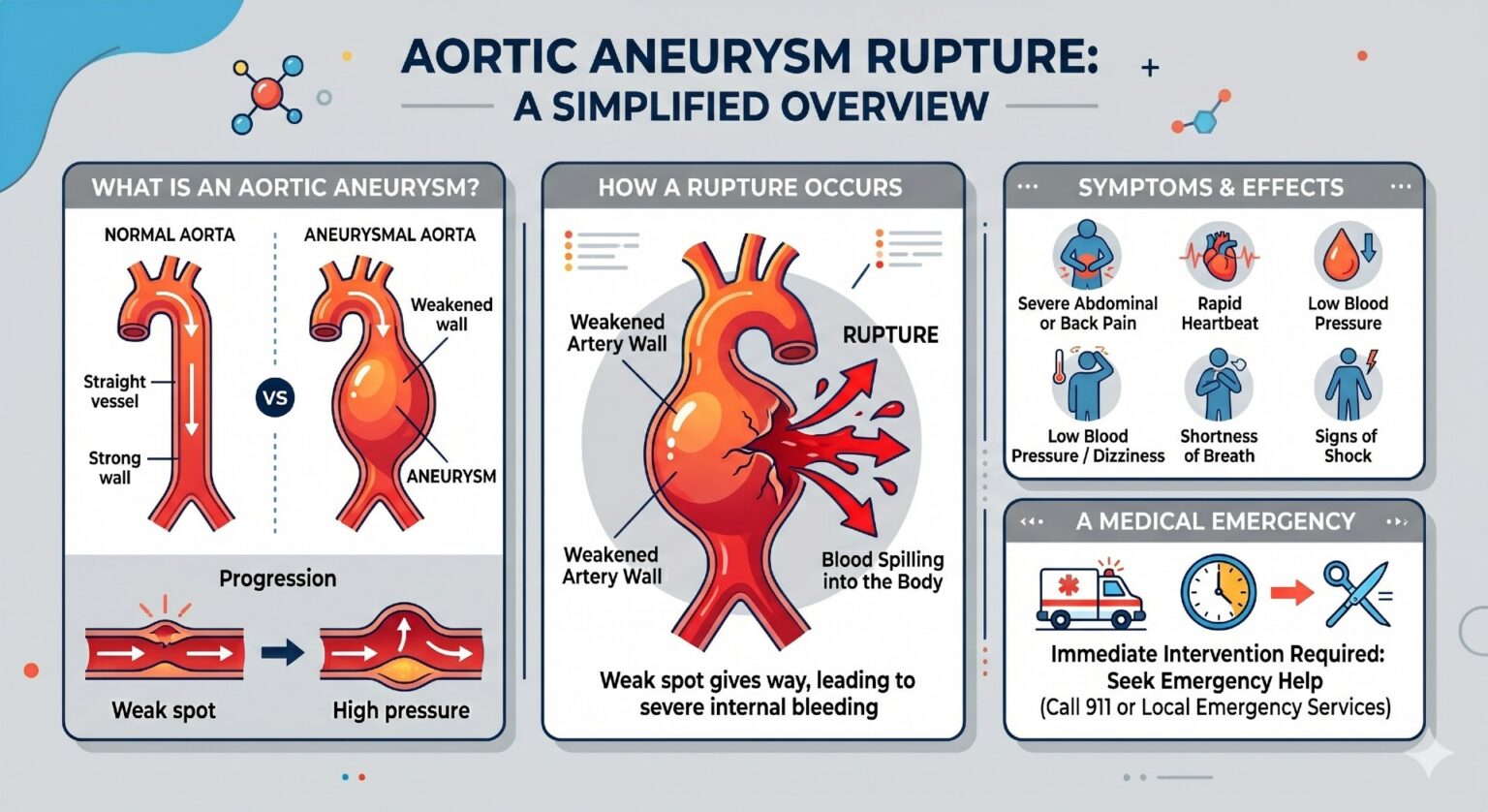 aortic aneurysm rupture simplified overview illustration